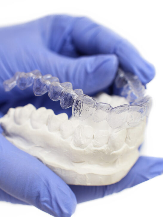 Retainer: types and information for the time after tooth correction