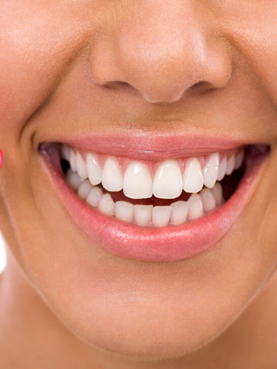 Invisalign vs Braces – what is the better Option?