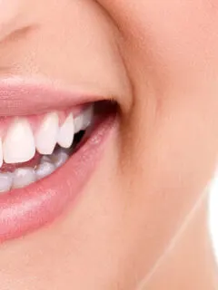 Woman smiling with and without braces - Are Invisible Aligners cheaper than Braces?