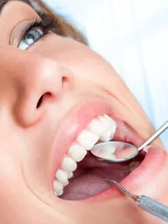 Young Woman smiling at the Dentist - Spacers for Braces