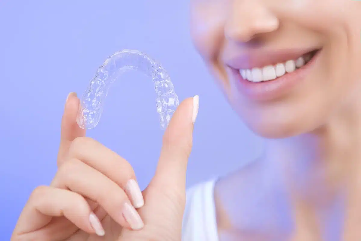 Average Cost of Braces per Month and how to calculate