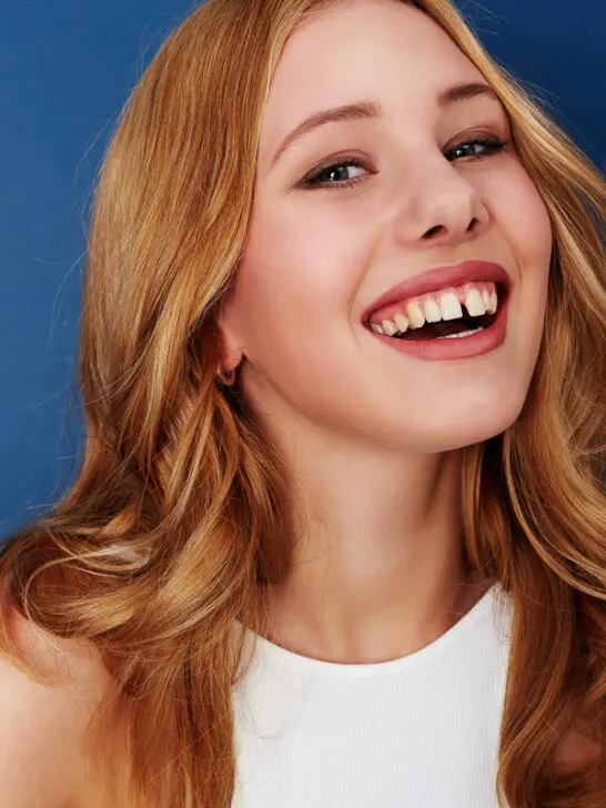 Braces Colors: Adding a Splash of Style to Orthodontic Treatment