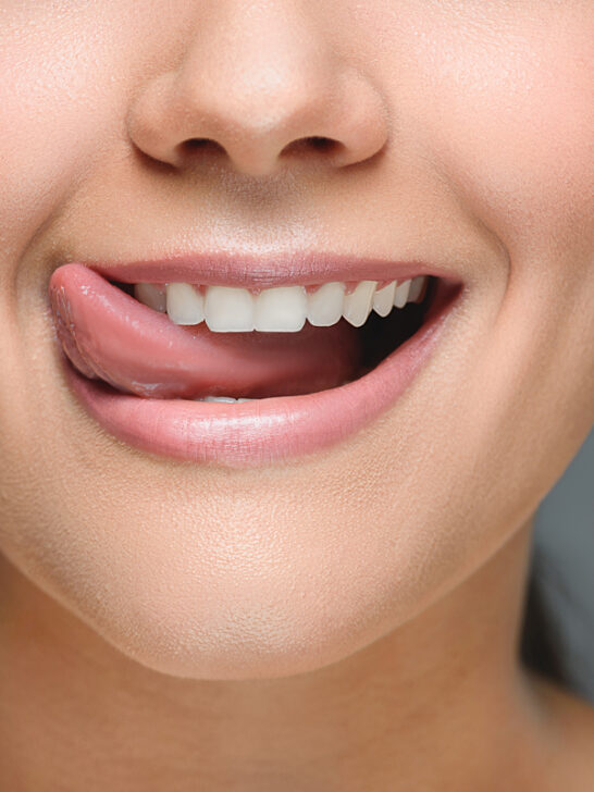What is a Retainer for Teeth?