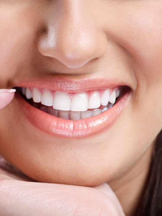 How do you get straight teeth? The best methods at a glance
