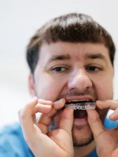 Mann setzt Aligner in den Mund ein - Wie schnell verschieben sich Zähne mit einer Zahnspange?
