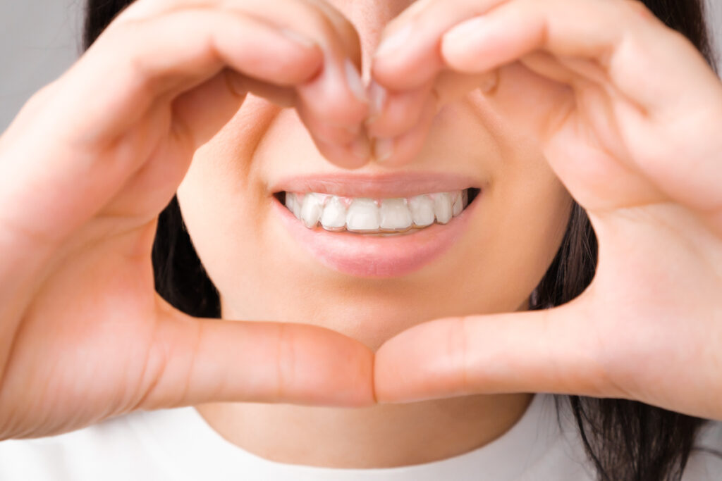 Lächelnde Frau formt mit ihren Händen Herz vor ihrem Gesicht - schiefe Zähne gerade machen