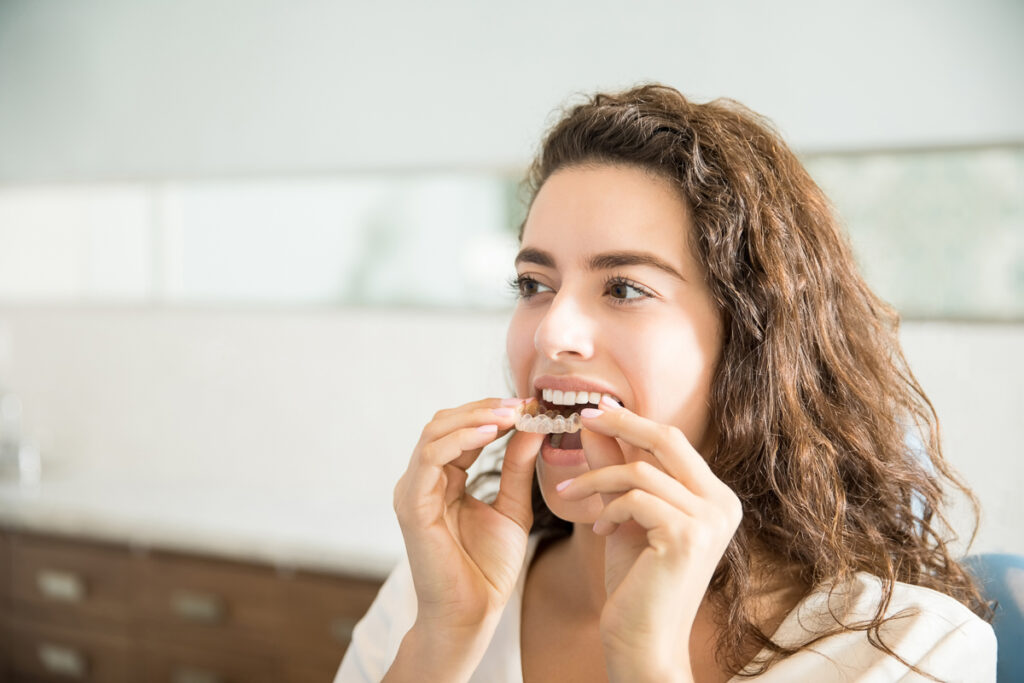 Ung kvinna sätter in tandskenor i munnen - Smile Direct Club erfarenheter