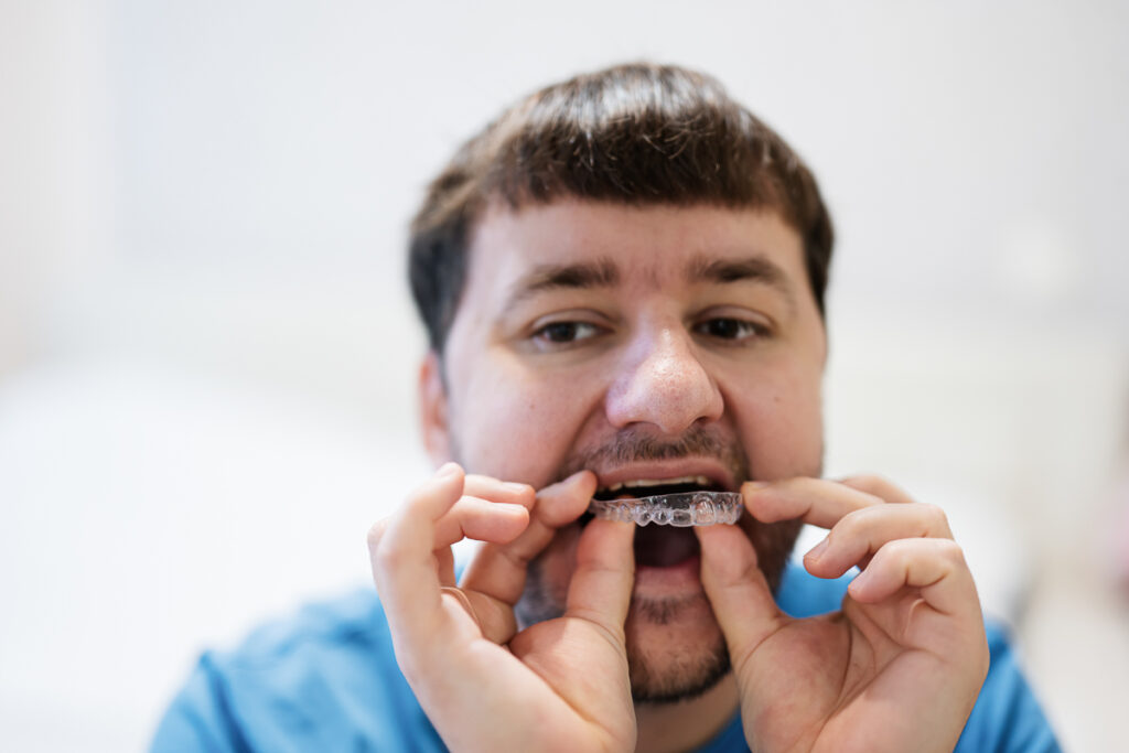 Man inserts invisible aligners