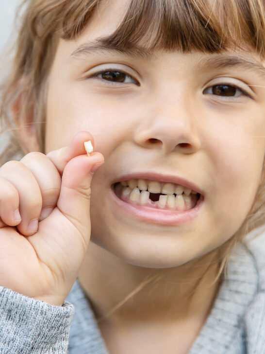 How many milk teeth does a person have? Everything about the primary dentition
