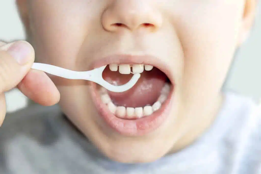How many milk teeth does a person have? Everything about the primary dentition 6 Care of milk teeth